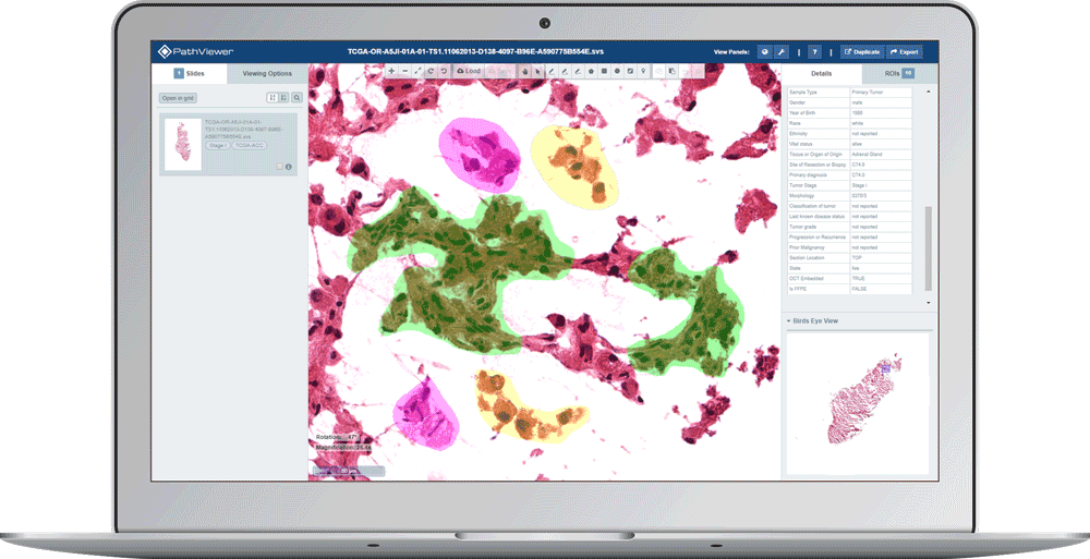 laptop display demonstrating the export feature to PDF of PathViewer, Glencoe Software’s digital pathology solution