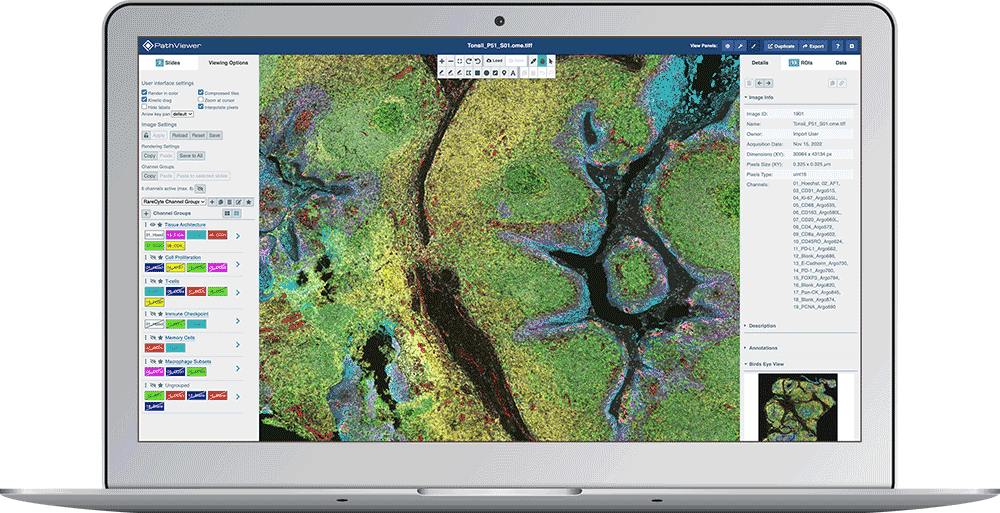 laptop display showing fluorescence image with multiple channels arranged in groups using PathViewer, Glencoe Software’s digital pathology solution