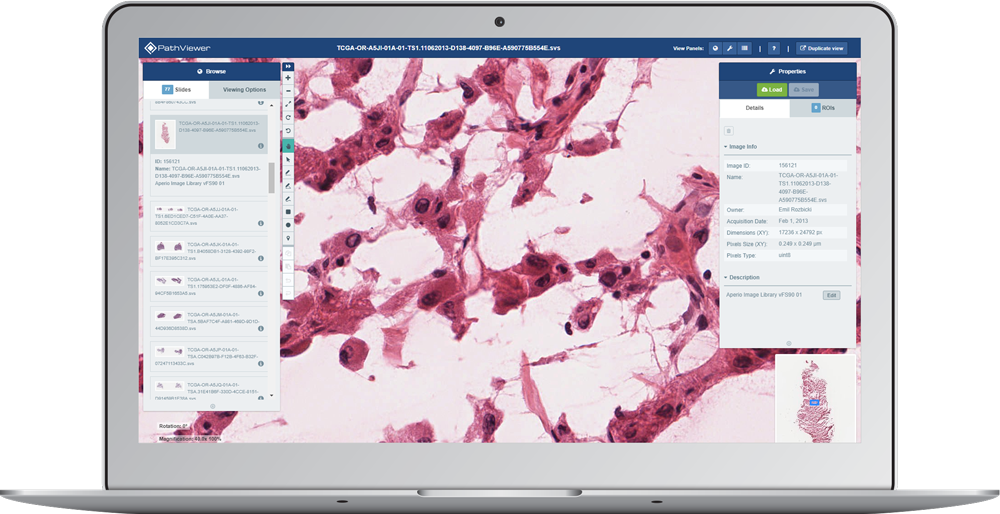 Digital Pathology Solutions by Glencoe Software