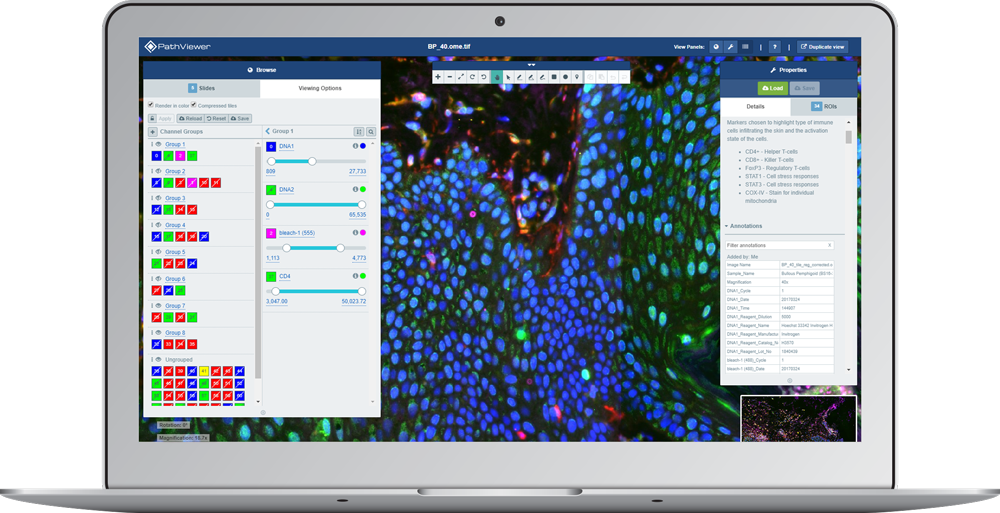 laptop display showing fluorescence image with multiple channels arranged in groups using PathViewer, Glencoe Software’s digital pathology solution