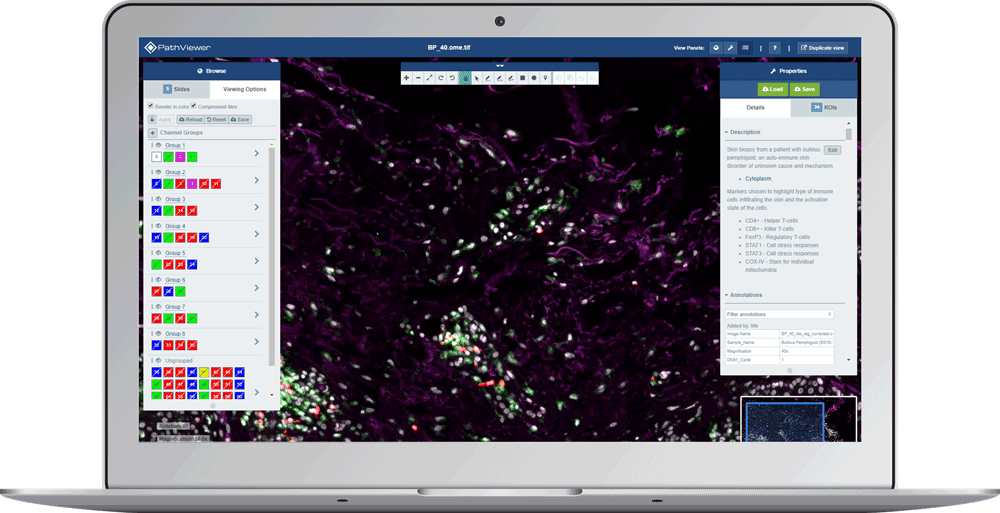 laptop screen showing multiple regions of interest (ROIs) on brightfield image, displayed on PathViewer