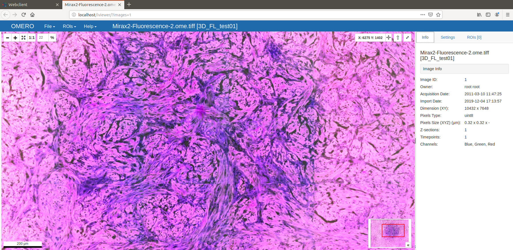 Converting Whole Slide Images To Ome Tiff A New Workflow Glencoe Software Inc